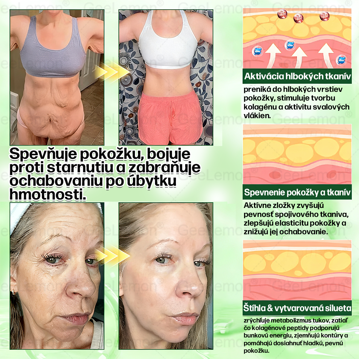 🌠| 🎁 𝐆𝐞𝑒𝐿𝑒𝐦𝐨𝐧® Glumasetide 8 v 1 Nano mikrotŕňový náplasť – Len raz denne ✅ Viditeľné zmeny za 7 dní na obezitu, ochabnutú pokožku a zdravie