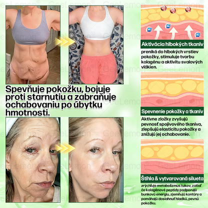 🌠| 🎁 𝐆𝐞𝑒𝐿𝑒𝐦𝐨𝐧® Glumasetide 8 v 1 Nano mikrotŕňový náplasť – Len raz denne ✅ Viditeľné zmeny za 7 dní na obezitu, ochabnutú pokožku a zdravie