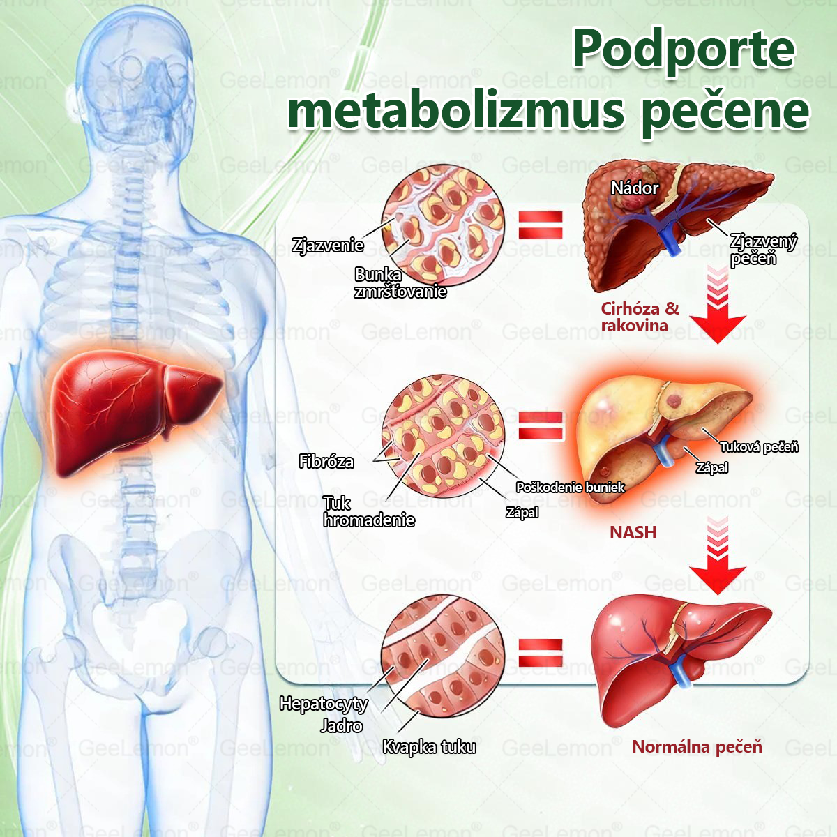 🌠| 🎁 𝐆𝐞𝑒𝐿𝑒𝐦𝐨𝐧® Glumasetide 8 v 1 Nano mikrotŕňový náplasť – Len raz denne ✅ Viditeľné zmeny za 7 dní na obezitu, ochabnutú pokožku a zdravie