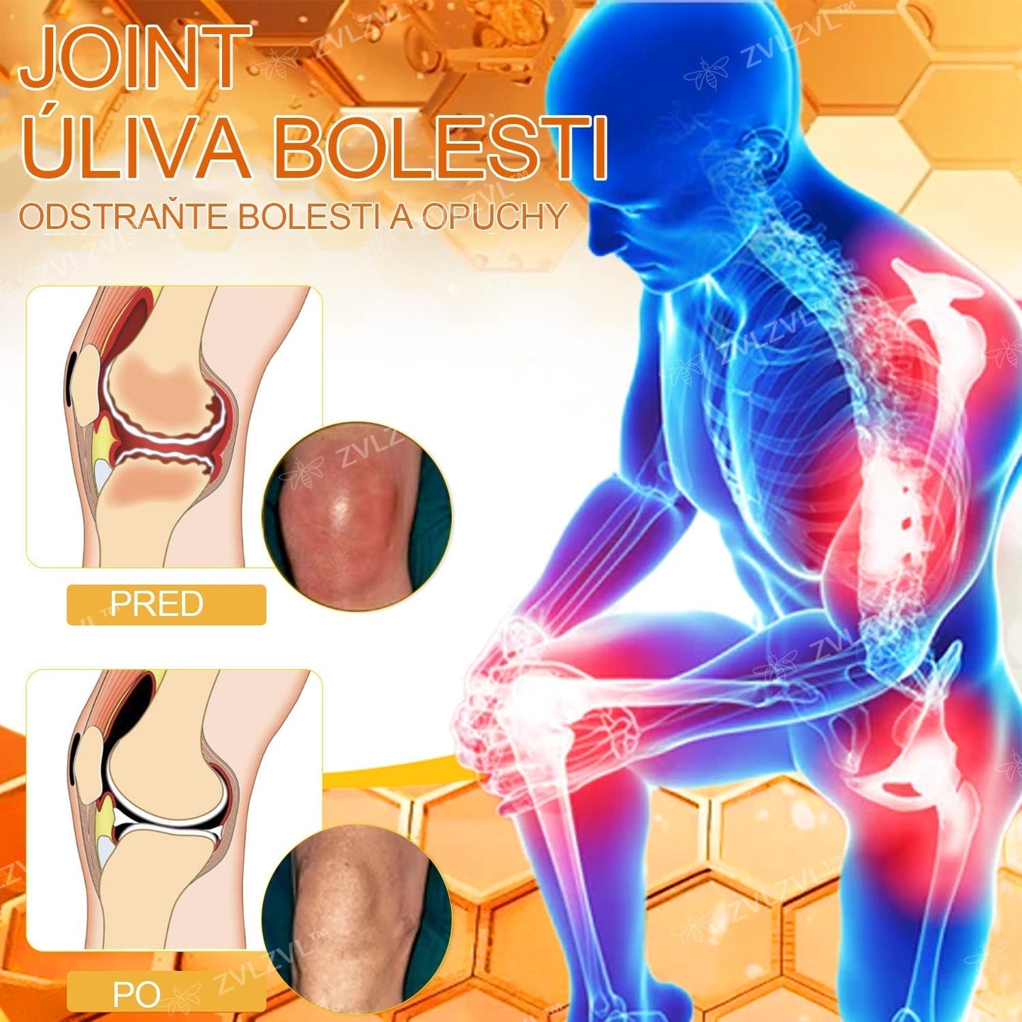 𝐙𝐕𝐋𝐙𝐕𝐋™  𝐕č𝐞𝐥í 𝐣𝐞𝐝 𝐨𝐤𝐚𝐦ž𝐢𝐭ý 𝐮𝐥𝐭𝐫𝐚 𝐬𝐢𝐥𝐧ý 𝐤𝐫é𝐦 𝐩𝐫𝐨𝐭𝐢 𝐛𝐨𝐥𝐞𝐬𝐭𝐢 - (𝐳𝐦𝐢𝐞𝐫ň𝐮𝐣𝐞 𝐛𝐨𝐥𝐞𝐬ť 𝐩𝐫𝐢 𝐚𝐫𝐭𝐫𝐢𝐭í𝐝𝐞, 𝐛𝐨𝐥𝐞𝐬𝐭𝐢 𝐬𝐯𝐚𝐥𝐨𝐯, 𝐜𝐡𝐫𝐛𝐭𝐚, 𝐤𝐨𝐥𝐢𝐞𝐧, 𝐜𝐡𝐫𝐛𝐭𝐚, 𝐫𝐚𝐦𝐢𝐞𝐧, 𝐛𝐨𝐤𝐨𝐯, 𝐳á𝐩ä𝐬𝐭í, 𝐫ú𝐤)