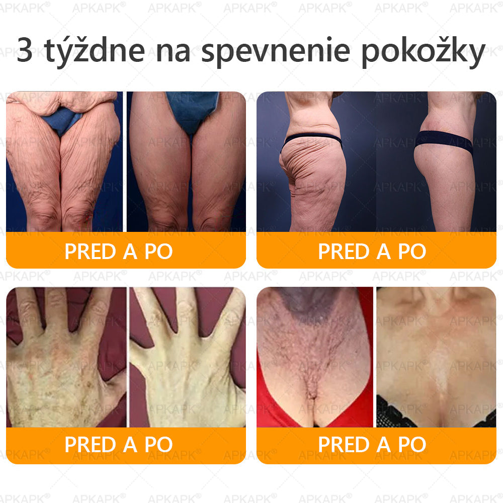 ✨Vyrobené a odoslané zo Slovenska ✨✨𝖠𝖯𝖪𝖠𝖯𝖪® 𝖡𝖾𝖾 𝗏𝖾𝗇𝗈𝗆 𝖪𝗋𝖾𝗆 𝗇𝖺 𝗈𝗉𝗋𝖺𝗏𝗎 𝗉𝗅𝖾𝗍𝗂