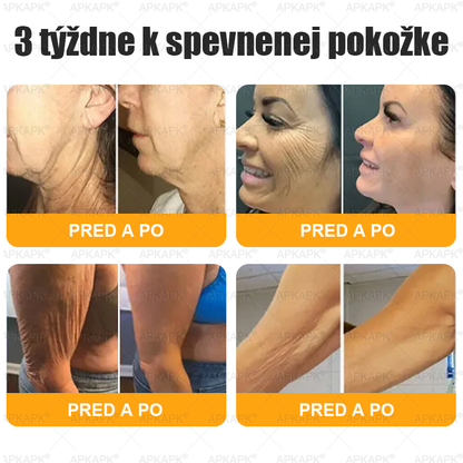 ✨Vyrobené a odoslané zo Slovenska ✨✨𝖠𝖯𝖪𝖠𝖯𝖪® 𝖡𝖾𝖾 𝗏𝖾𝗇𝗈𝗆 𝖪𝗋𝖾𝗆 𝗇𝖺 𝗈𝗉𝗋𝖺𝗏𝗎 𝗉𝗅𝖾𝗍𝗂