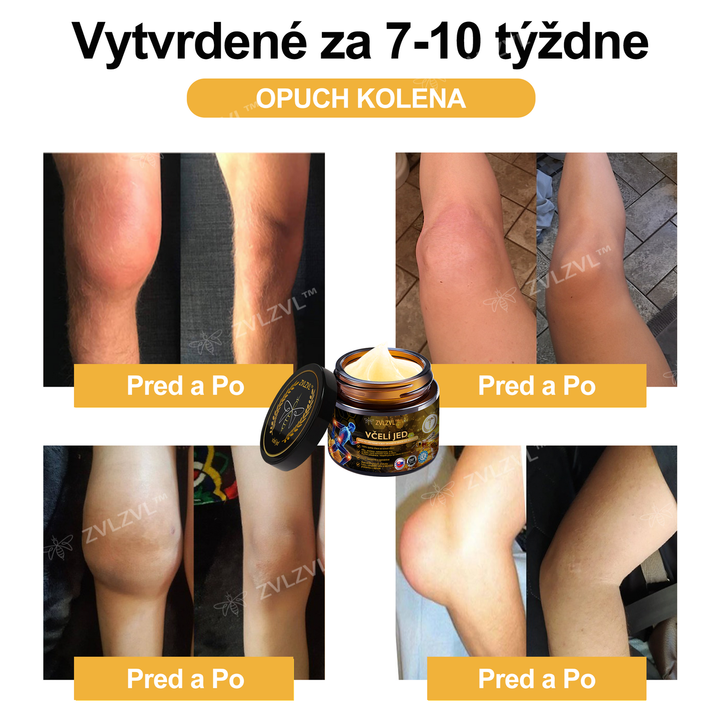 𝐙𝐕𝐋𝐙𝐕𝐋™  𝐕č𝐞𝐥í 𝐣𝐞𝐝 𝐨𝐤𝐚𝐦ž𝐢𝐭ý 𝐮𝐥𝐭𝐫𝐚 𝐬𝐢𝐥𝐧ý 𝐤𝐫é𝐦 𝐩𝐫𝐨𝐭𝐢 𝐛𝐨𝐥𝐞𝐬𝐭𝐢 - (𝐳𝐦𝐢𝐞𝐫ň𝐮𝐣𝐞 𝐛𝐨𝐥𝐞𝐬ť 𝐩𝐫𝐢 𝐚𝐫𝐭𝐫𝐢𝐭í𝐝𝐞, 𝐛𝐨𝐥𝐞𝐬𝐭𝐢 𝐬𝐯𝐚𝐥𝐨𝐯, 𝐜𝐡𝐫𝐛𝐭𝐚, 𝐤𝐨𝐥𝐢𝐞𝐧, 𝐜𝐡𝐫𝐛𝐭𝐚, 𝐫𝐚𝐦𝐢𝐞𝐧, 𝐛𝐨𝐤𝐨𝐯, 𝐳á𝐩ä𝐬𝐭í, 𝐫ú𝐤)