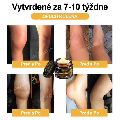 𝐙𝐕𝐋𝐙𝐕𝐋™  𝐕č𝐞𝐥í 𝐣𝐞𝐝 𝐨𝐤𝐚𝐦ž𝐢𝐭ý 𝐮𝐥𝐭𝐫𝐚 𝐬𝐢𝐥𝐧ý 𝐤𝐫é𝐦 𝐩𝐫𝐨𝐭𝐢 𝐛𝐨𝐥𝐞𝐬𝐭𝐢 - (𝐳𝐦𝐢𝐞𝐫ň𝐮𝐣𝐞 𝐛𝐨𝐥𝐞𝐬ť 𝐩𝐫𝐢 𝐚𝐫𝐭𝐫𝐢𝐭í𝐝𝐞, 𝐛𝐨𝐥𝐞𝐬𝐭𝐢 𝐬𝐯𝐚𝐥𝐨𝐯, 𝐜𝐡𝐫𝐛𝐭𝐚, 𝐤𝐨𝐥𝐢𝐞𝐧, 𝐜𝐡𝐫𝐛𝐭𝐚, 𝐫𝐚𝐦𝐢𝐞𝐧, 𝐛𝐨𝐤𝐨𝐯, 𝐳á𝐩ä𝐬𝐭í, 𝐫ú𝐤)