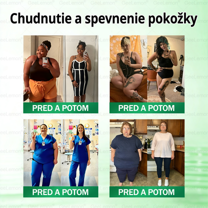 🌠| 🎁 𝐆𝐞𝑒𝐿𝑒𝐦𝐨𝐧® Glumasetide 8 v 1 Nano mikrotŕňový náplasť – Len raz denne ✅ Viditeľné zmeny za 7 dní na obezitu, ochabnutú pokožku a zdravie