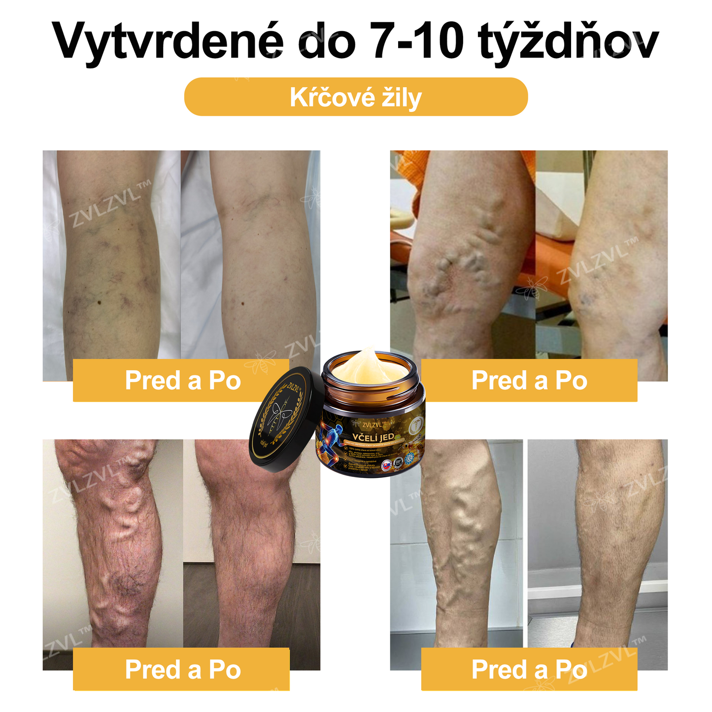 𝐙𝐕𝐋𝐙𝐕𝐋™  𝐕č𝐞𝐥í 𝐣𝐞𝐝 𝐨𝐤𝐚𝐦ž𝐢𝐭ý 𝐮𝐥𝐭𝐫𝐚 𝐬𝐢𝐥𝐧ý 𝐤𝐫é𝐦 𝐩𝐫𝐨𝐭𝐢 𝐛𝐨𝐥𝐞𝐬𝐭𝐢 - (𝐳𝐦𝐢𝐞𝐫ň𝐮𝐣𝐞 𝐛𝐨𝐥𝐞𝐬ť 𝐩𝐫𝐢 𝐚𝐫𝐭𝐫𝐢𝐭í𝐝𝐞, 𝐛𝐨𝐥𝐞𝐬𝐭𝐢 𝐬𝐯𝐚𝐥𝐨𝐯, 𝐜𝐡𝐫𝐛𝐭𝐚, 𝐤𝐨𝐥𝐢𝐞𝐧, 𝐜𝐡𝐫𝐛𝐭𝐚, 𝐫𝐚𝐦𝐢𝐞𝐧, 𝐛𝐨𝐤𝐨𝐯, 𝐳á𝐩ä𝐬𝐭í, 𝐫ú𝐤)