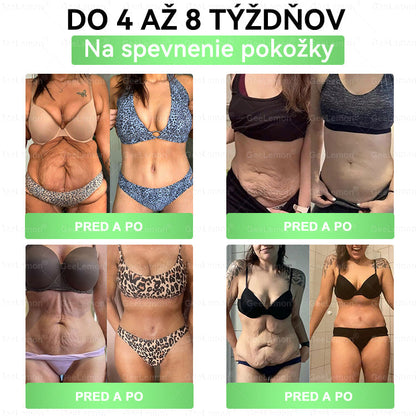 🌠| 🎁 𝐆𝐞𝑒𝐿𝑒𝐦𝐨𝐧® Glumasetide 8 v 1 Nano mikrotŕňový náplasť – Len raz denne ✅ Viditeľné zmeny za 7 dní na obezitu, ochabnutú pokožku a zdravie