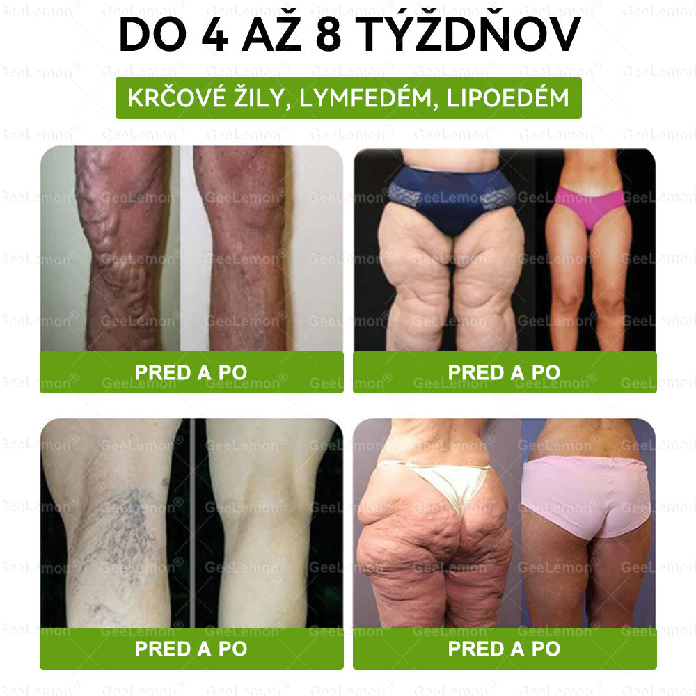 🌠| 🎁 𝐆𝐞𝑒𝐿𝑒𝐦𝐨𝐧® Glumasetide 8 v 1 Nano mikrotŕňový náplasť – Len raz denne ✅ Viditeľné zmeny za 7 dní na obezitu, ochabnutú pokožku a zdravie