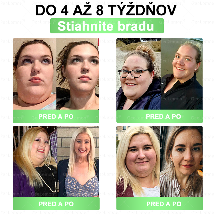 🌠| 🎁 𝐆𝐞𝑒𝐿𝑒𝐦𝐨𝐧® Glumasetide 8 v 1 Nano mikrotŕňový náplasť – Len raz denne ✅ Viditeľné zmeny za 7 dní na obezitu, ochabnutú pokožku a zdravie